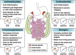 Inflammatory bowel disease (IBD) - AGA GI Patient Center