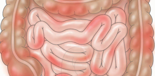 Gut