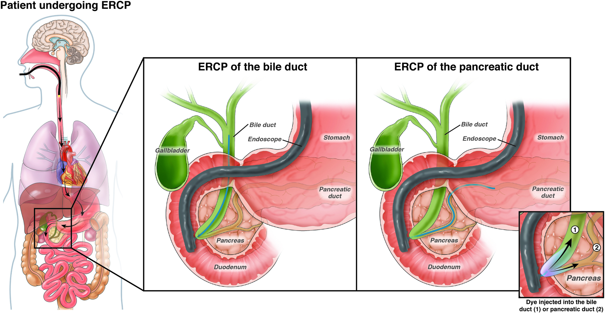 What Is The Purpose Of An Endoscopic Ultrasound