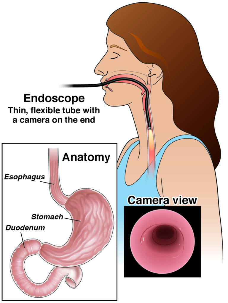 esophagus and stomach