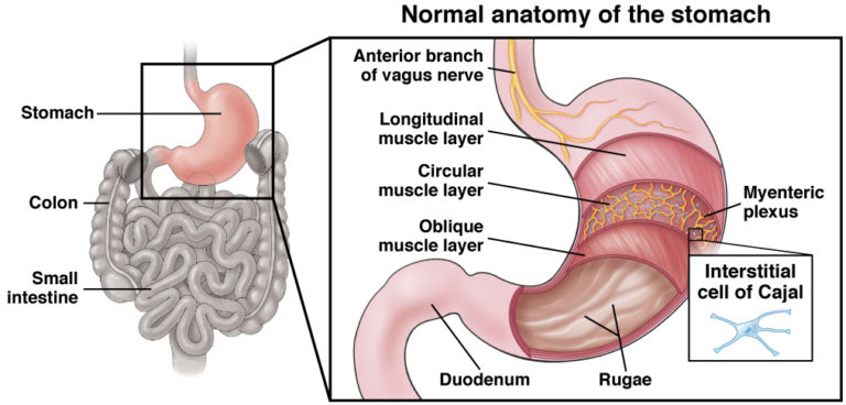 Gastroparesis - AGA GI Patient Center