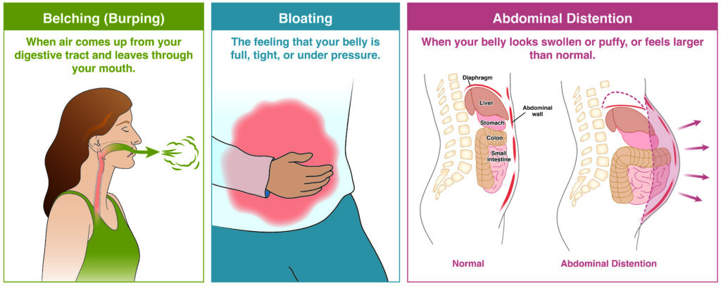 Illustration of belching (burping), bloating, and abdominal distention in the body.